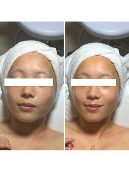 ワイアンドワイ(Y&Y)/ビフォーアフター