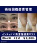 術後回酸素管理【むくみ解消,腫れ緩和】インディバ,ダウンタイム短縮ケア