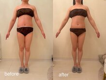 クロレ 浦和店(CLORE)/30代のお客様/12回施術