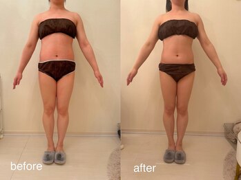 クロレ 浦和店(CLORE)/30代のお客様/12回施術