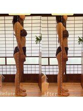 ボッカ(bocca)/筋膜リリースBefore After