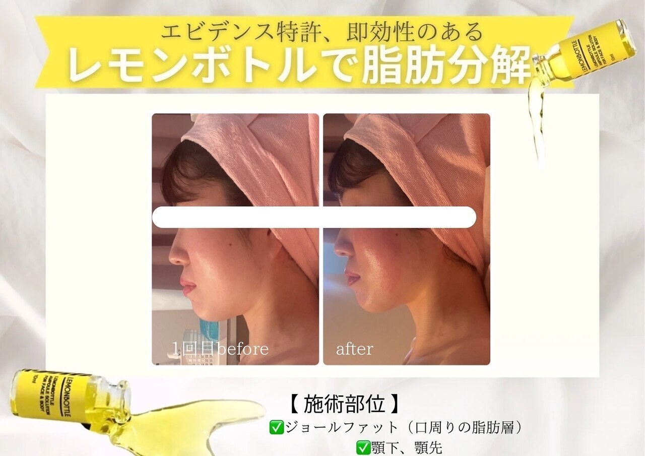 エステティックサロン フェアリー(ESTHETIC SALON FAIRLY