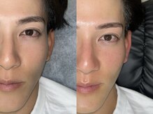 ニューブロウ 堺筋本町店(NEUBROW)/美肌フェイシャル