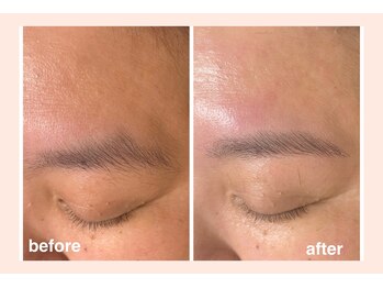 アップル マリー 江別/■糸脱毛（似合わせ眉毛脱毛）