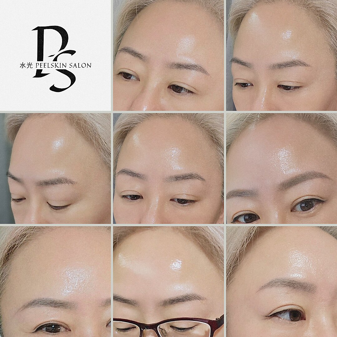 水光ピールスキン｜ホットペッパービューティー