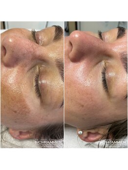 オリエンタルグリーン 銀座(ORIENTAL GREEN)/グリーンピール