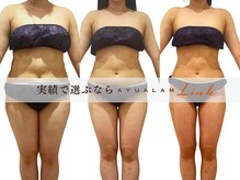 アユアランリンク 錦糸町店