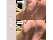 ドクターネイル爪革命 群馬両毛店の雰囲気（１度のケアで歩行が驚くほど楽に♪タコや爪周りの角質もスッキリ）