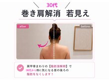 クリニカルエステ/イーズ パークプレイス大分店の雰囲気(1回の施術です!首の後ろの脂肪を撃退し、若見えポジションに!)
