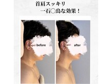 サロン シェリール(Salon Cherir)の雰囲気(たるみ撲滅!眠れるほど痛みが少ない《小顔調整》が人気です♪)