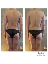 サプナジー(Suppnrgy)/カスタムトリートメント