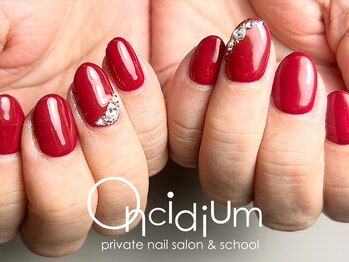 オンシジューム(Oncidium)/ボルトーネイル♪