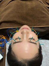 エクステンド鍼灸整体院(extend鍼灸整体院)/美容鍼