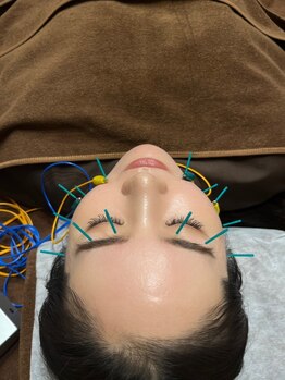 エクステンド鍼灸整体院(extend鍼灸整体院)/美容鍼