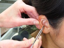 エメ ルーチェ(aimer luce)/耳ツボで満腹感を早め、サポート