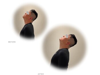 整体ライト 国分寺店(LIGHT)/Before→After（首・頭）