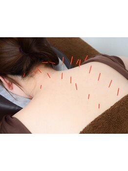 首・肩のつらさを改善したい