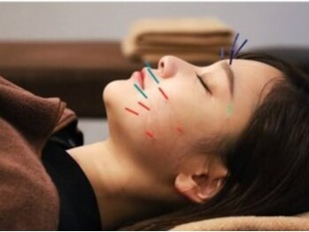 うめきた鍼灸院 センス(SENSE)の写真/【梅田中津】小顔美容鍼灸*立体造顔美◇《洗練されたデザイナーズ×電位空間》自分へのご褒美&効果持続◎