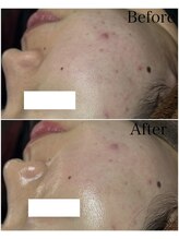 ブラックボックス(BLACK BOX)/20代女性のお客様