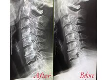 ソルヴィス(SOLVIS)/