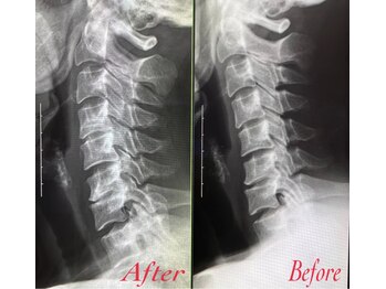 ソルヴィス(SOLVIS)/