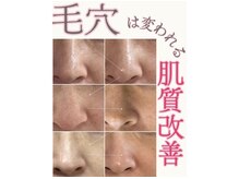 マヴィ 藤井寺店(MavY.)/毛穴洗浄×水光注入で美毛穴へ
