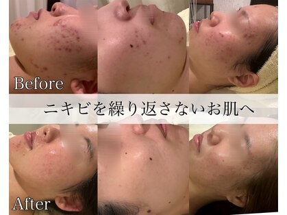ビオローザ 横浜桜木町店(BioRosa)の写真