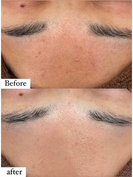 ルヴィ 浦添店(REVI)/