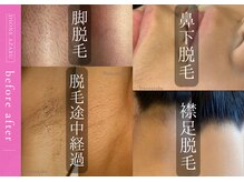 ディオーネ 麻布十番(Dione)の雰囲気（【ビフォーアフター】効果主義だからしっかり綺麗になくせる◎）
