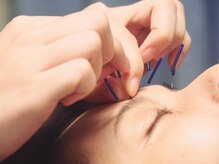 ビハダ(BIHADA)の雰囲気（有資格者による美容鍼施術で美へのサポートを！［町田/美容鍼］）