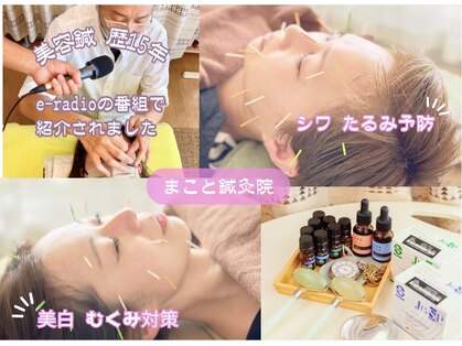 まこと鍼灸院の写真