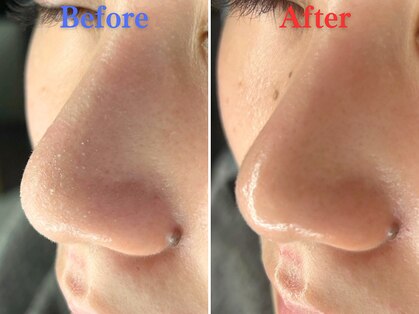 ボーンオム(Born Homme)の写真