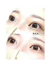 アンフィズム(annfism)/