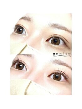 アンフィズム(annfism)/