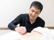 まこと治療院/お灸