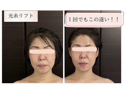 ホルバールウェルネス(Hallbar Wellness)の写真