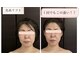 ホルバールウェルネス(Hallbar Wellness)の写真