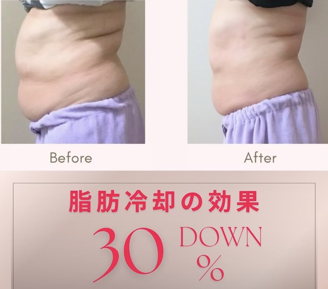 スリム(SLIM by lily of the valley)｜ホットペッパービューティー