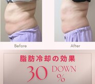 スリム(SLIM by lily of the valley)