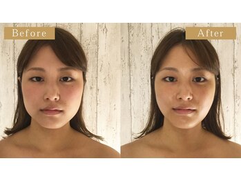 グレースフィオーレ 町田店(gracefiore)/お客様のビフォーアフターその１