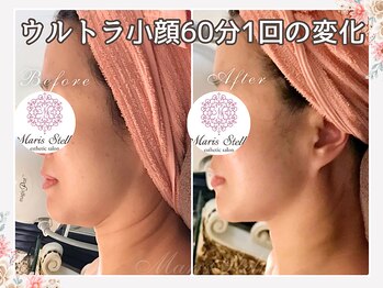 マリスステラ 天王寺(MarisStella)/フェースラインと首に注目！