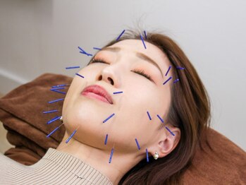 MK鍼灸整骨院 堀江店の写真/【リピート率94%!受けなきゃ損!】小顔矯正×美容鍼×ヘッドスパのトリプル施術◎スッキリ感がやみつきに!
