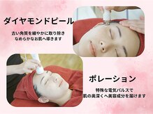 ポラリス(Polaris)/ダイヤモンドとポレーション