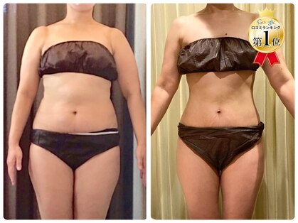 美容整体ウェリナ あま甚目寺院の写真