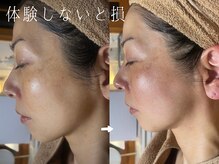 サロンドシエル カスガイ(Salon de Ciel kasugai)/たるみも毛穴も、肌ごとリセット