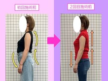 八女整体院/～肩こり・反り腰改善～