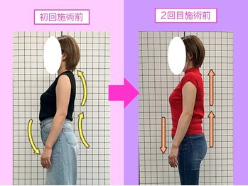 八女整体院/~肩こり・反り腰改善~
