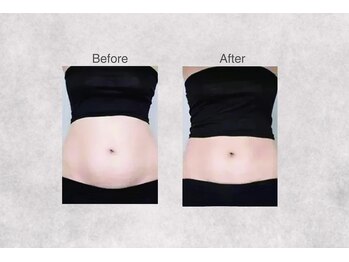 ミセル 尾道店(MYTHEL)/before　after　ウエスト