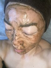 リラ 都城店(Lilas)/ハーブピーリング