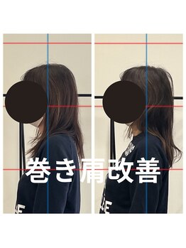 熊本カワル整体 JR上熊本駅院/巻き肩改善